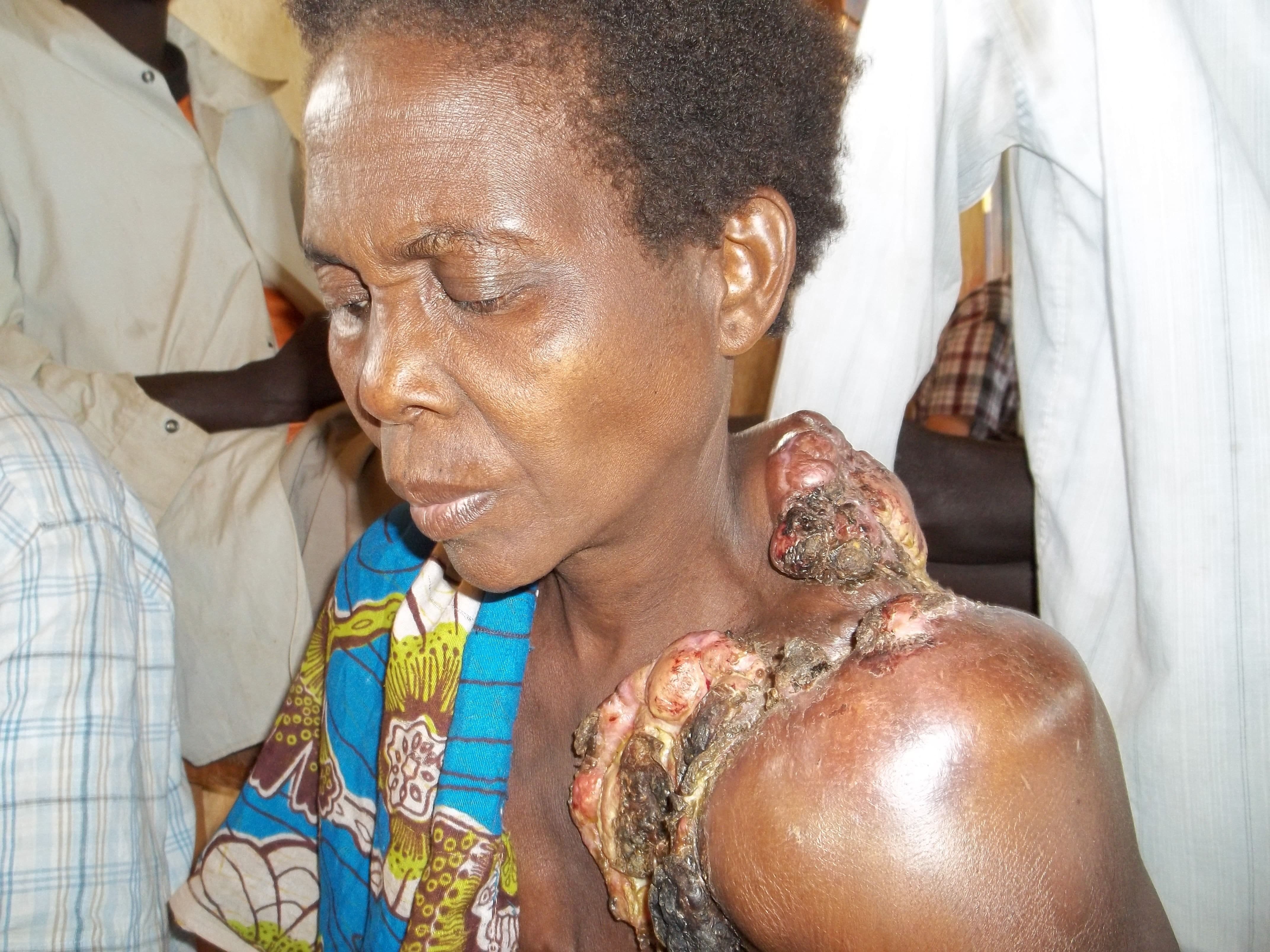 A Woman Receiving Medical Care